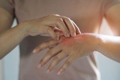 Formaldehyde has been banned in EU cosmetics since 2019 but formaldehyde releasers were still widely used and have to carry warning labels when formaldehyde concentrations are found above 0.05% in the final product [Getty Images]