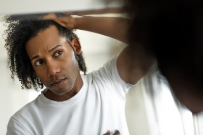 L'Oréal wants to specifically direct its methods towards predicting androgenetic alopecia in men - known as male-pattern baldness [Getty Images]